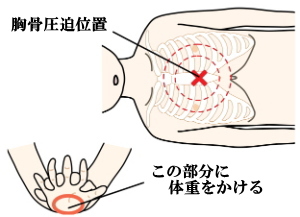胸骨圧迫位置