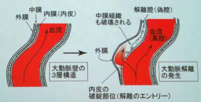 大動脈の断面図