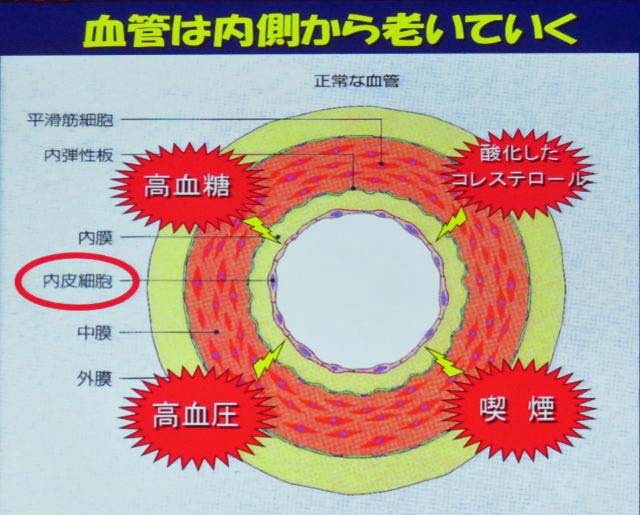 血管の老化