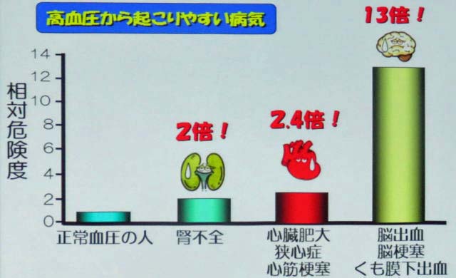 高血圧関連の疾患