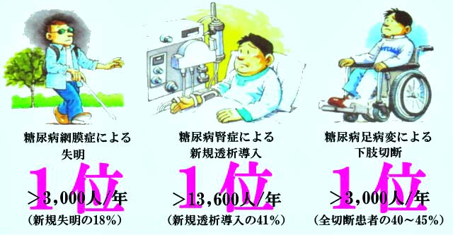 糖尿病最小血管症