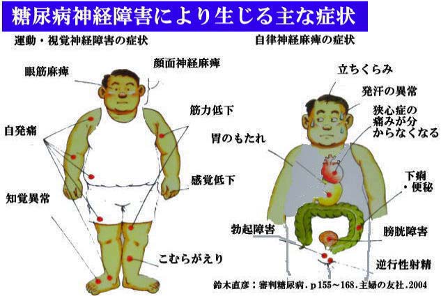 糖尿病神経障害で生じる主な症状