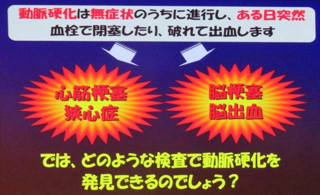 動脈硬化は無症状