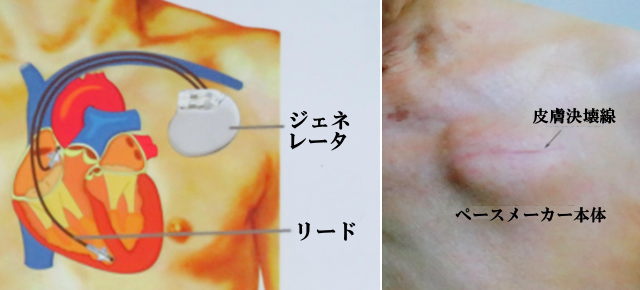 刺激伝導系