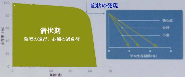 大動脈弁狭窄症の進行