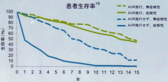 大動脈弁狭窄症の進行