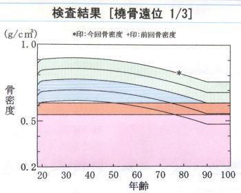 骨密度