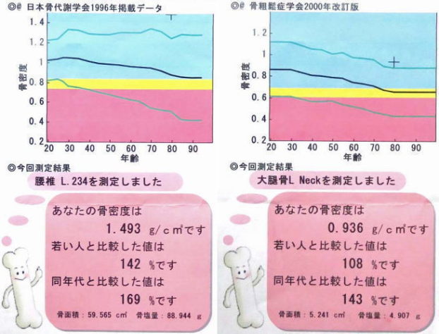 私の骨密度