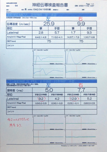 神経伝導検査結果